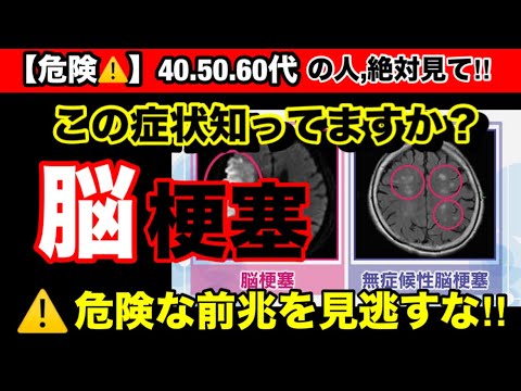 【医療関係監修】脳梗塞の典型的な症状と見逃せないサインとオススメ予防食材３選！