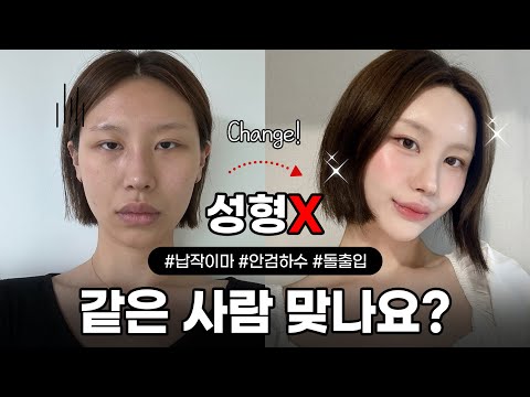 유앤미 강남본점 홍보팀 마케터가 필러&실리프팅 직접 경험해봤습니다🔥