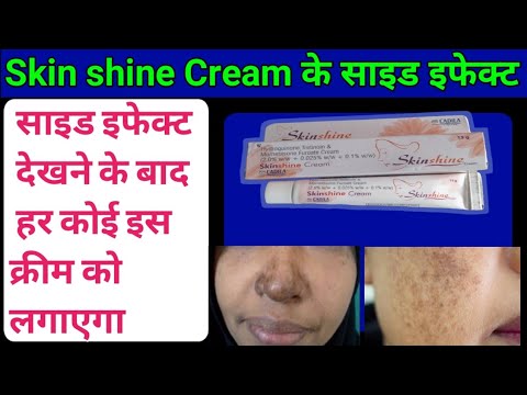 Skin shine Cream के side effect देखने के बाद हर कोई इस क्रीम को लगाएगा l Side effects of skin shine