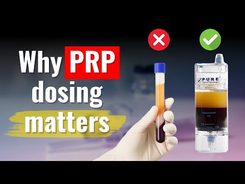 How Platelet Dosing Affects PRP Injection Outcomes