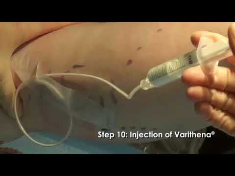 Varithena® Video - Heart & Vascular Care