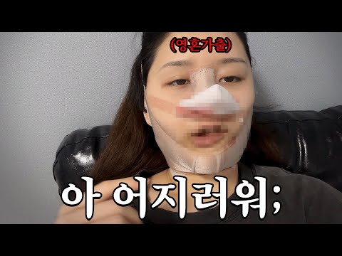 이게 찐 성형후기지.. 마취도 안 깨고 찍은 리얼 코성형후기😎🔥 [티티2Vlog]