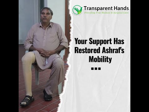 Muhammad Ashraf's Leg was Successfully Installed by Transparent Hands