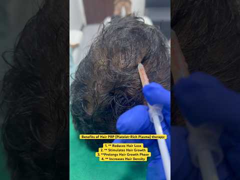 #hair transplant #hair #hairloss #besthairtransplant #drpranilmore #ytshorts #shorts #highdensity