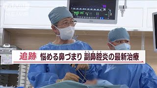 痛い手術…驚きの器具で進化 「副鼻腔炎」患者200万人　患者負担減らす最新“鼻”治療【Jの追跡】(2023年7月16日)