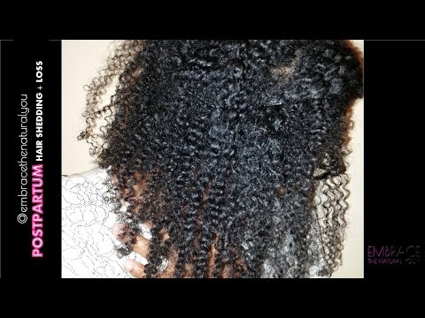 Natural Hair | Postpartum Hair Loss and Shedding