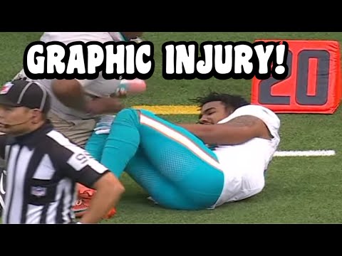 Jaylen Waddle LEG INJURY 🙏 Dolphins Vs Texans 2024