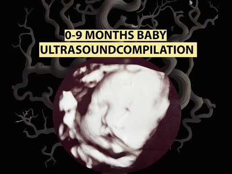 SOME WERE SCARY | 0-9 MONTHS BABY ULTRASOUND COMPILATION