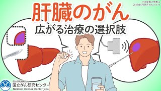 【治療】肝臓のがんの治療法を公開！広がる治療の選択肢について徹底解説します！【肝がん】