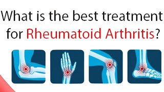 Omega XL Rheumatoid Arthritis Relief in 2023, Become Pain Free Naturally Now!