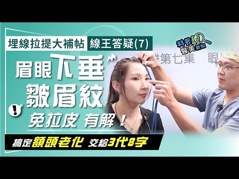 埋線拉提大補帖｜線王答疑(7)眉眼下垂、額頭鬆弛 誰說只能前額拉皮手術？　線雕拉提3代8字就能搞定！ 一次同步解放緊鎖皺眉紋 科普醫美新知364-20241018