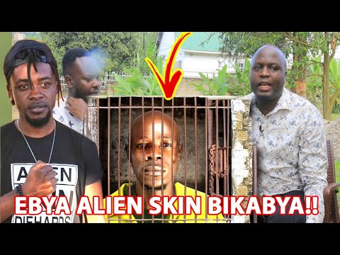 Embeera Etabukidde #Alien Skin mu Komera e Luzira! Edwaliro Ly'e Nsambya Litabuse - Saymore Kawalata