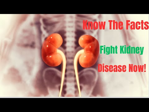 Early Signs Of Kidney Damage – 8 Warning Sign That Your Kidney Are In Danger