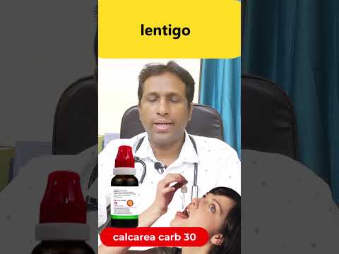 lentigo treatment #shorts #health #healthtips #gyan #shortvideo #viral #facts #food