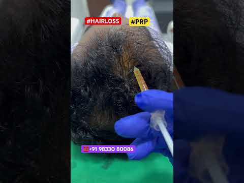 Best Hair Loss Treatments | Hair PRP | #shorts #hair #haircare #prp #ytshorts #drpranilmore