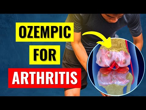 What Science ACTUALLY Says About Ozempic / Wegovy / Zepbound for Arthritis