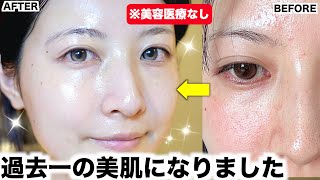 【冬スキンケア】毛穴も肌荒れもひどかった私が圧倒的美肌を手に入れたスキンケアルーティン【乾燥肌】