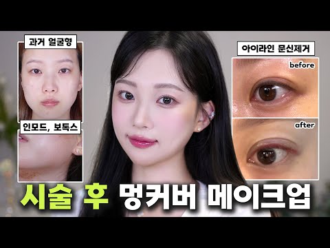 Skin bruise cover makeup after in-mode laser treatment / How to make your face pretty.,