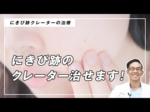 【にきび跡のクレーター】あきらめないで！にきび跡のクレーター治せます！！