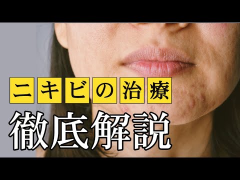 【ドクター解説】保険治療でのニキビの治し方について【新宿南口皮膚科】