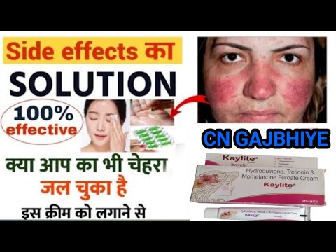 kaylite Cream | Kaylite cream के साइड इफेक्ट कैसे ठीक करे | Kaylite cream के side effect solutions