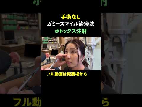 【ガミースマイル治療法】笑ったときに歯ぐきが大きく見えるコンプレックスは治せる！思いきり笑える！【手術なし】#ガミースマイル