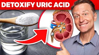 The Ultimate Kidney Cleanse for Uric Acid and Gout: Dr. Berg's Proven Techniques