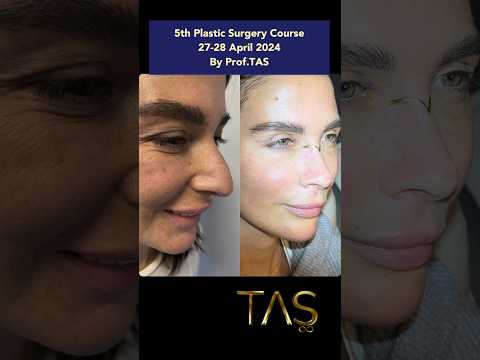 How I did it?5th Plastic Surgery Course, 27-28 April 2024 #drsuleymantas