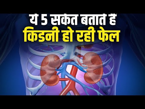 #10 Kidney (Renal) Disease Signs & Symptoms(eg- Peripheral Edema , Fatigue, Itchiness) #viral #video