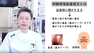 耳鼻咽喉科専門医が教える　好酸球性副鼻腔炎/山口大学病院