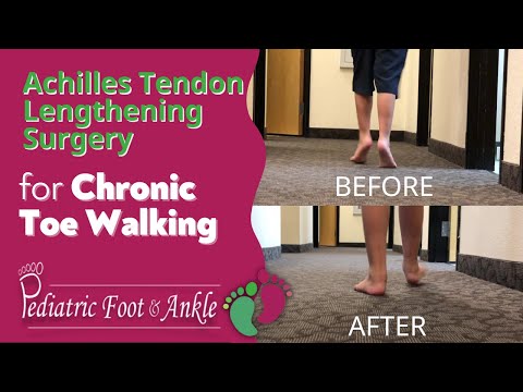 Achilles Tendon Lengthening Surgery for Toe Walking Male 7 Years Old