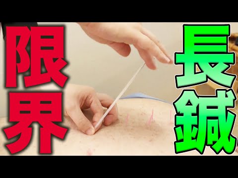 【肩こり 解消 福岡】疲労と肩こりに長鍼治療！強敵の肩こりを院長は解消できるのでしょうか？！【福岡美容鍼灸サロンCanna】