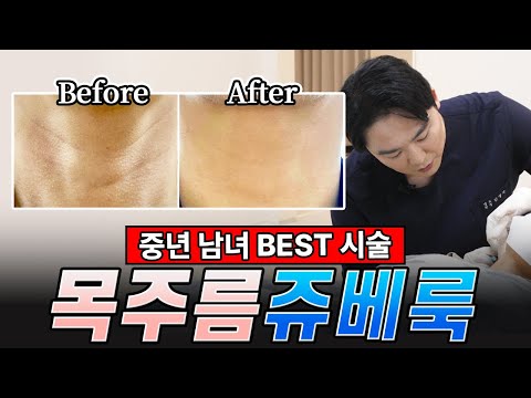 40, 50대 중년 남녀 BEST 시술은? | 중년남녀의 고민 목주름 없애는 시술 공개!