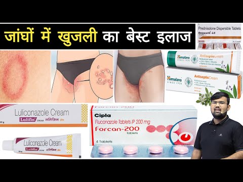 जांघों में संक्रमण | Fungal Infection | Ringworm | Medicine | Treatment | Pharmacy | Doctor | MBBS