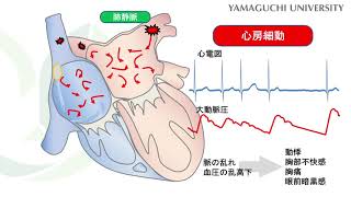 知っちょる？山大病院⑲ 循環器内科