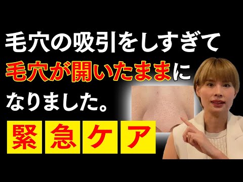 【Q&A回答】毛穴吸引しすぎて毛穴が開いたまま！緊急ケア