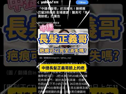 中捷「長髮正義哥」臉上的疤，可以完全消除嗎？#shorts #中捷