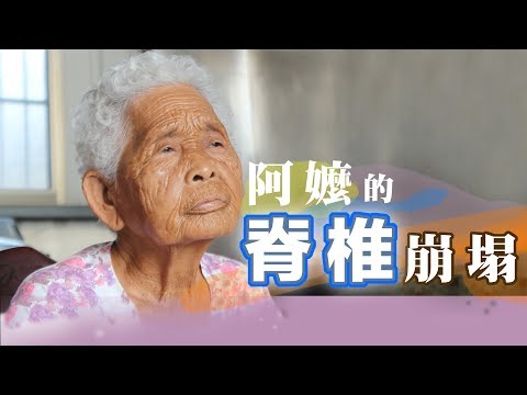 阿嬤的脊椎崩塌