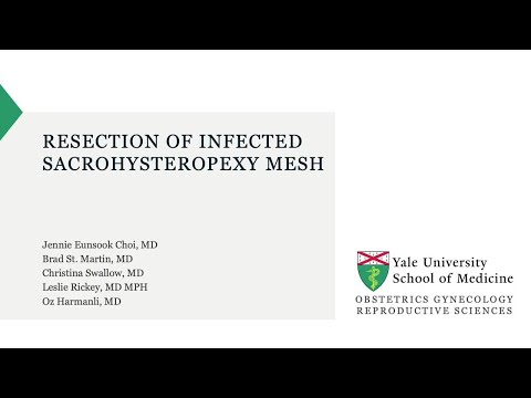 Resection of Infected Sacrohysteropexy Mesh