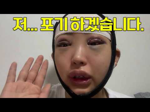 수술 직후 모습 이게 맞아요? 눈도 제대로 못 뜨고 다녔던 날💦💦[신지예Vlog]