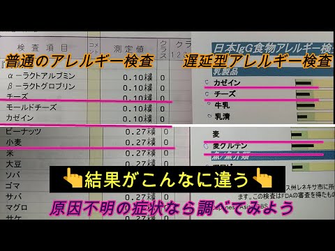 結果が全然違う2種類のアレルギー検査。原因不明の体調不良やアレルギーならぜひ検査を！