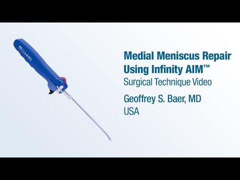 Dr. Geoffrey Baer - Medial Meniscus Repair Using Infinity AIM™ - CONMED Surgical Technique