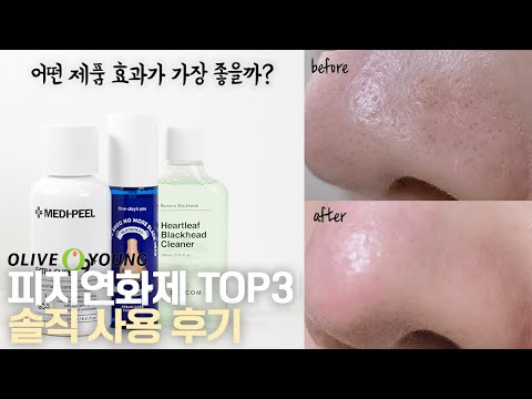 피지연화제, 블랙헤드 제거 정말 잘 될까?🔍 (ft.연화제 효과 높이는 방법💚)