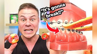 Braces VS Freeze Dried Peach Rings