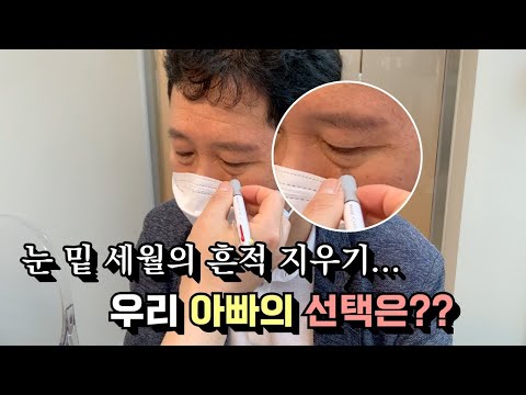 60대 아버지 세월의 흔적 지워드리기! 눈밑지방재배치 리얼후기ㅣ모즈의원- 모즈클리닉