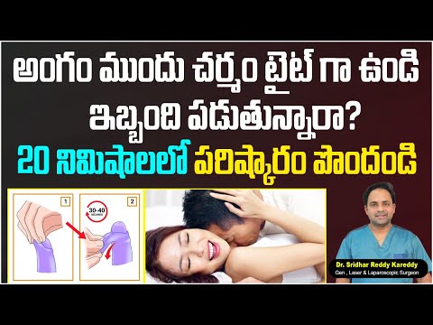 How to Fix Tight Frenulum? || KSR Stapler Circumcision in Hyderabad || Treatment Range Hospital