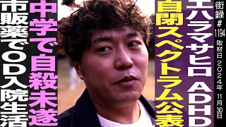 エハラマサヒロ/吉本興業退社の真相/発達障害アスペ公表/市販薬でODした少年時代