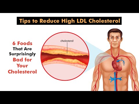 6 Foods That Are Surprisingly Bad for Your Cholesterol | Tips to Reduce High LDL Cholesterol