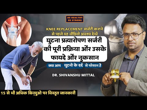 Knee Replacement Surgery in 2024 | Complete Guide in Hindi | Dr Shivanshu Mittal