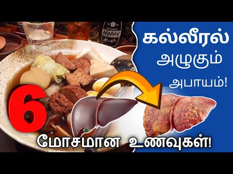 கல்லீரலை அழுகவைக்கும் 06 உணவுகள்/These 06 foods can damage your liver/#health_tips_tamil/#healthtips